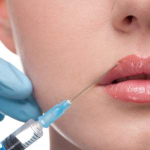 Filler Periorale Ilenia Pontillo