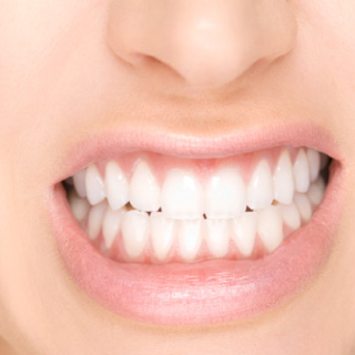 Bruxismo Galliate Novara