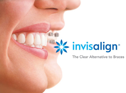 Invisalign Galliate Novara