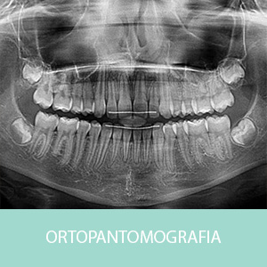 //www.ileniapontillo.it/wp-content/uploads/2022/11/ortopantomografia-panoramica-dentale-galliate.jpg