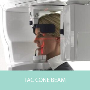 tac cone beam a galliate