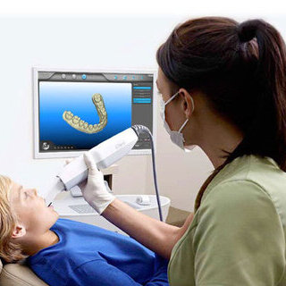 Scanner Intraorale impronte 3D Galliate Novara